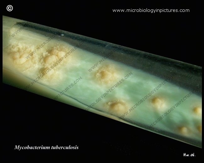 L�wenstein-Jensen medium in a tube